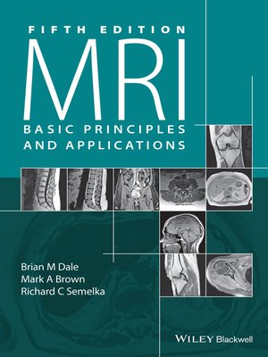 cover image of MRI